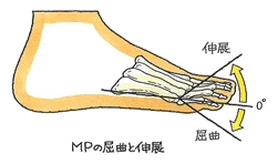 MPの屈曲と伸展