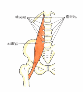 腰椎横突起骨折（正面）