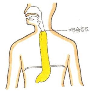 胃管吊り上げ術